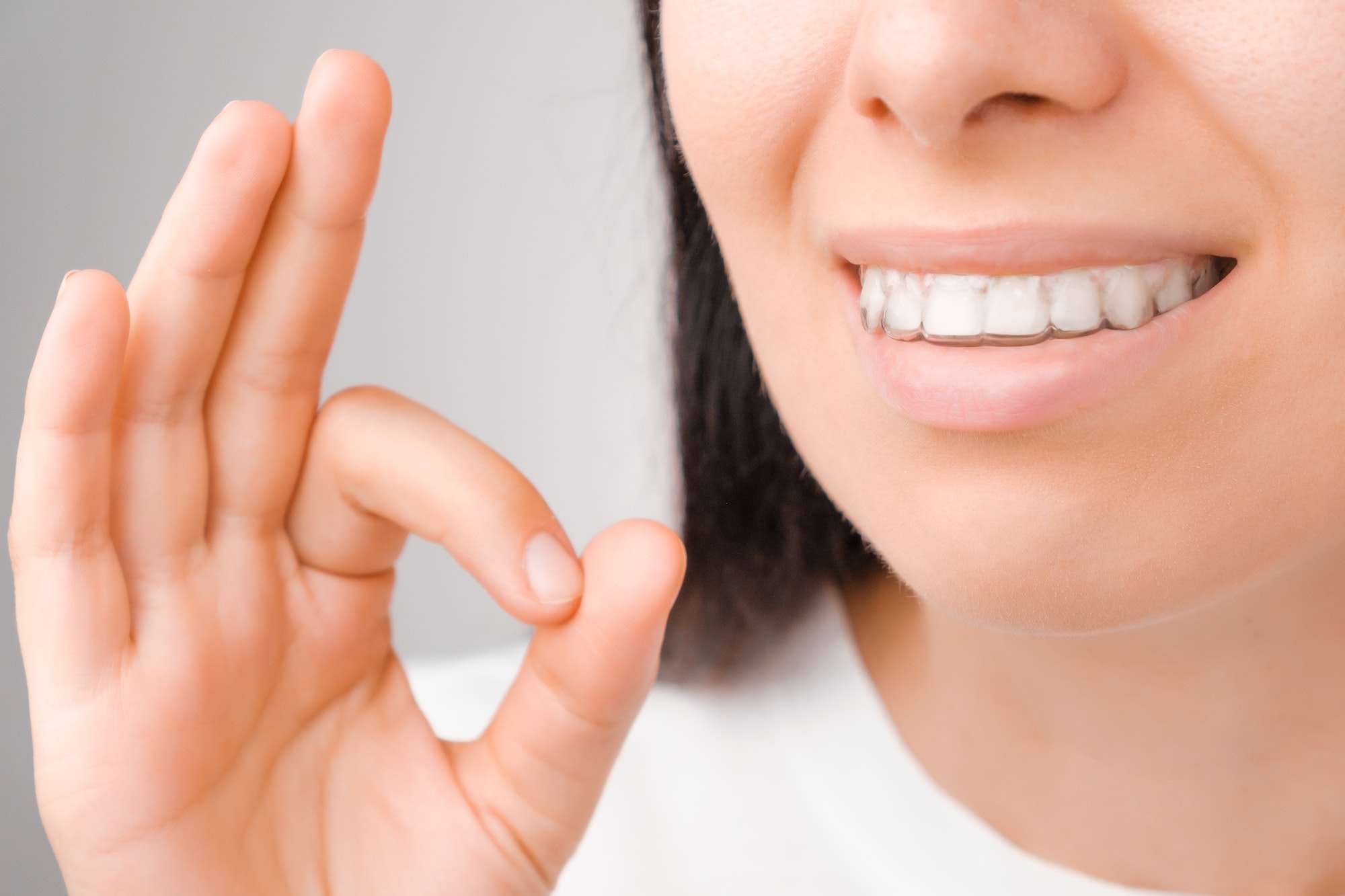 Happy woman with a perfect smile in transparent aligners on her teeth shows sign OK. Removable