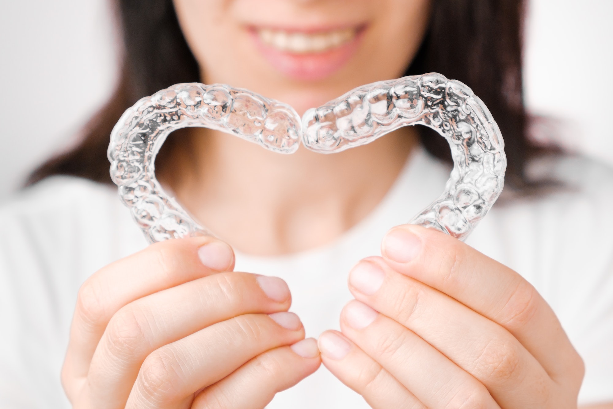 Making heart from aligners or removable braces
